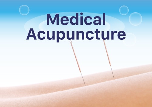 Medical Acupuncture Treatment Ashford Kent